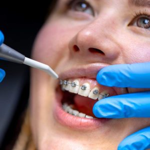 Ortodoncia en Zorroza