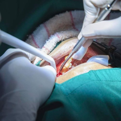 Endodoncia en Zorroza